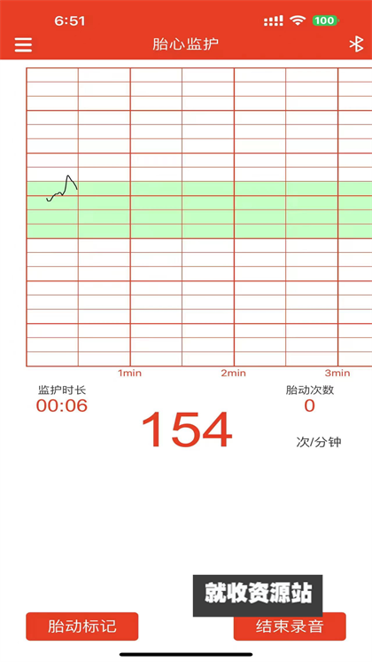 左点胎心仪app官方最新版下载